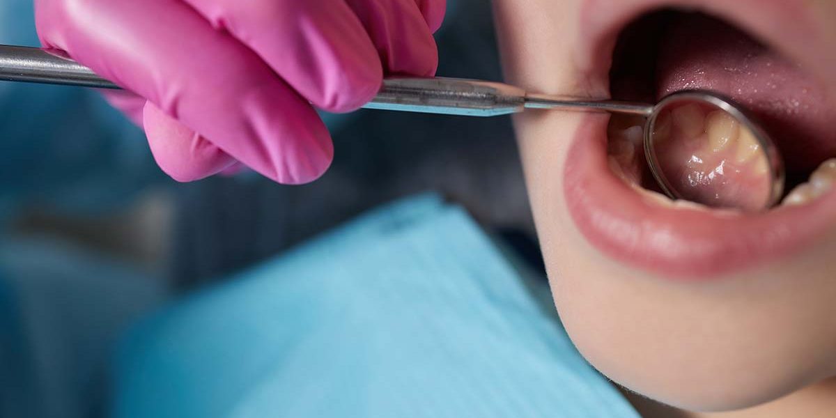 What Is Dental Preventative Care?