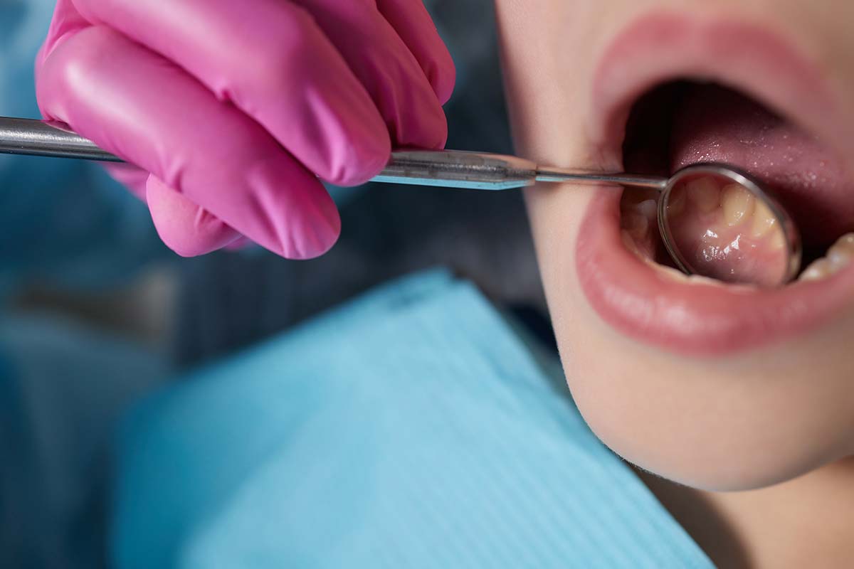 What Is Dental Preventative Care?