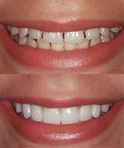 dental care smile