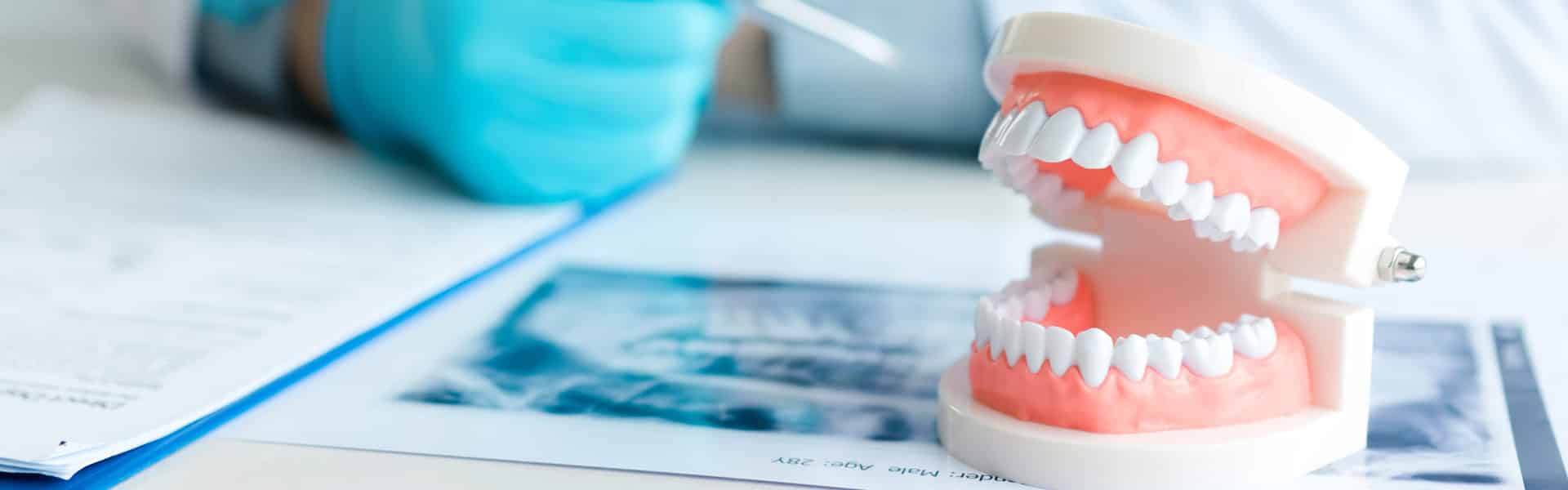 dentures dentures