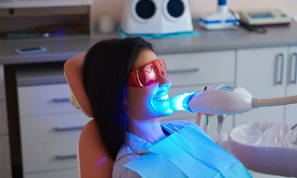 how long does professional teeth whitening last