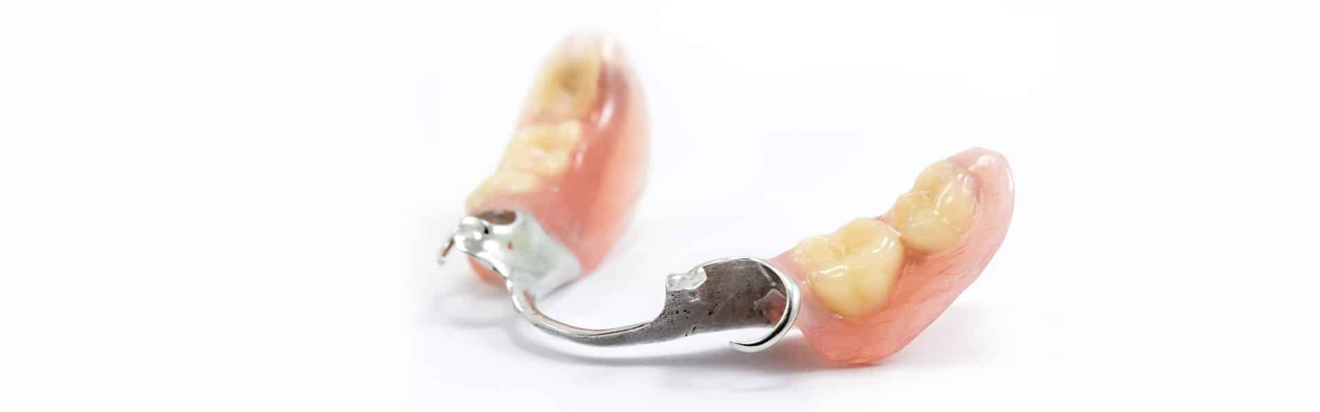 Partial Dentures